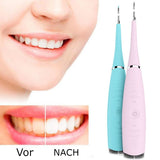 Trency | Teeth Cleaner®